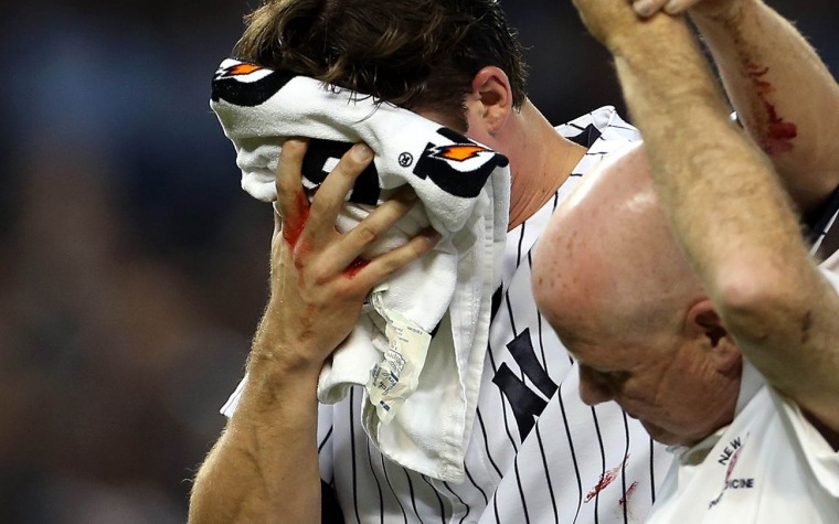 Video: Bryan Mitchell sufre fractura